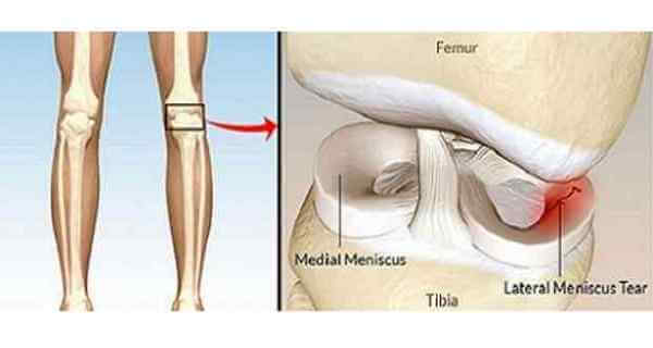 Regenerate Cartilage In Your Knees Hips And Joints