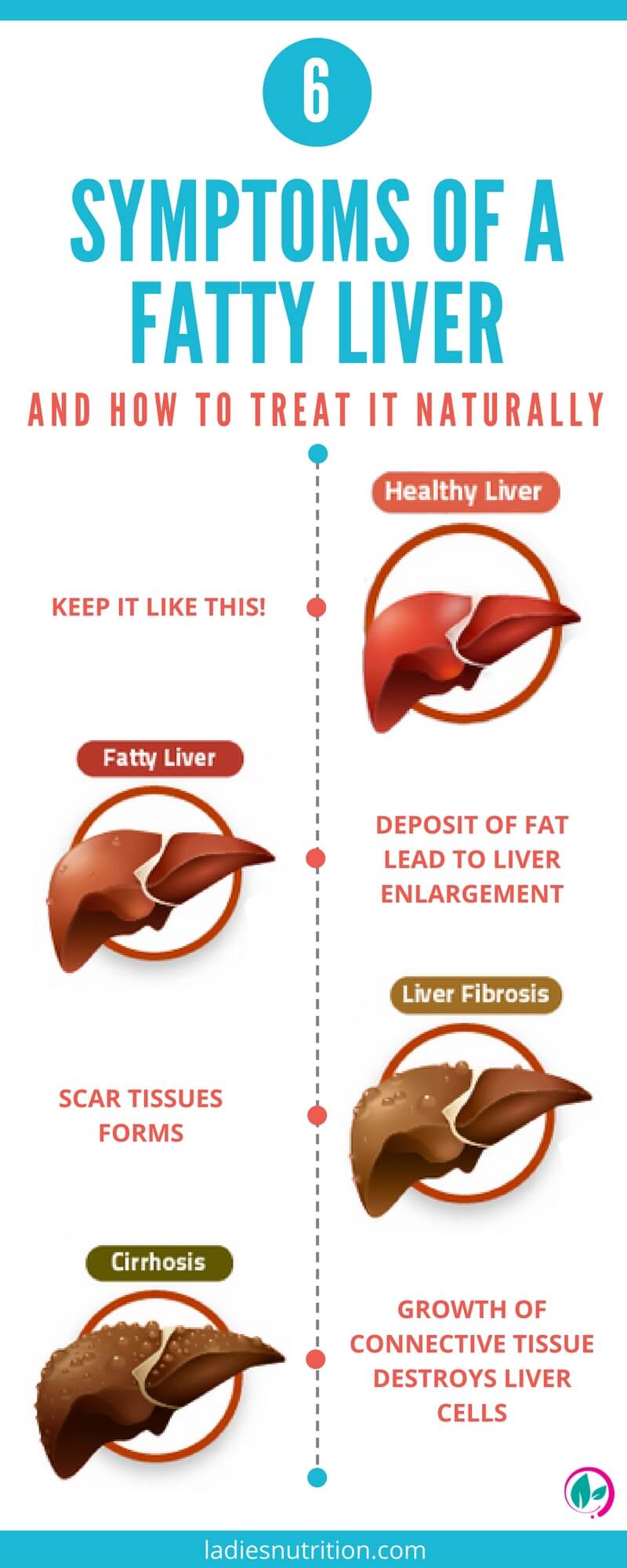 6-symptoms-of-a-fatty-liver-and-how-to-treat-it-naturally